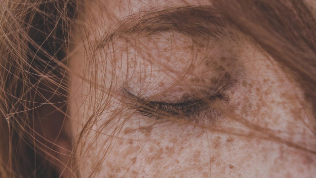 Foto Blog Date nach Trennung: Geschlossenes Auge mit Sommersprossen und verwehtem Haar davor